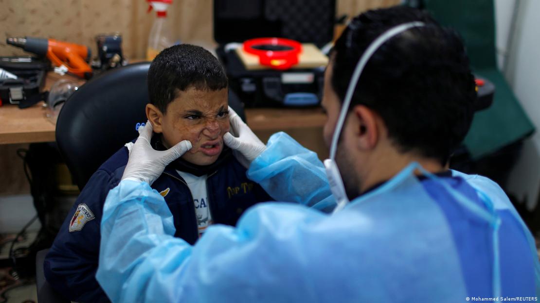 Qyteti i Gazës: Një fëmijë me diegie në fytyrë duke marrë trajtim në një klinikë të Mjekëve Pa Kufij